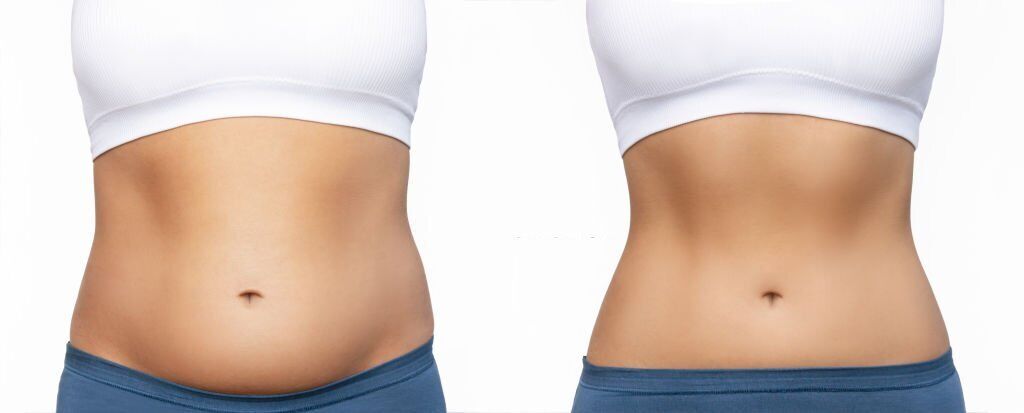 How To Lose Belly Fat FAST - Skinny Girl Lipo Cavitation Experience 